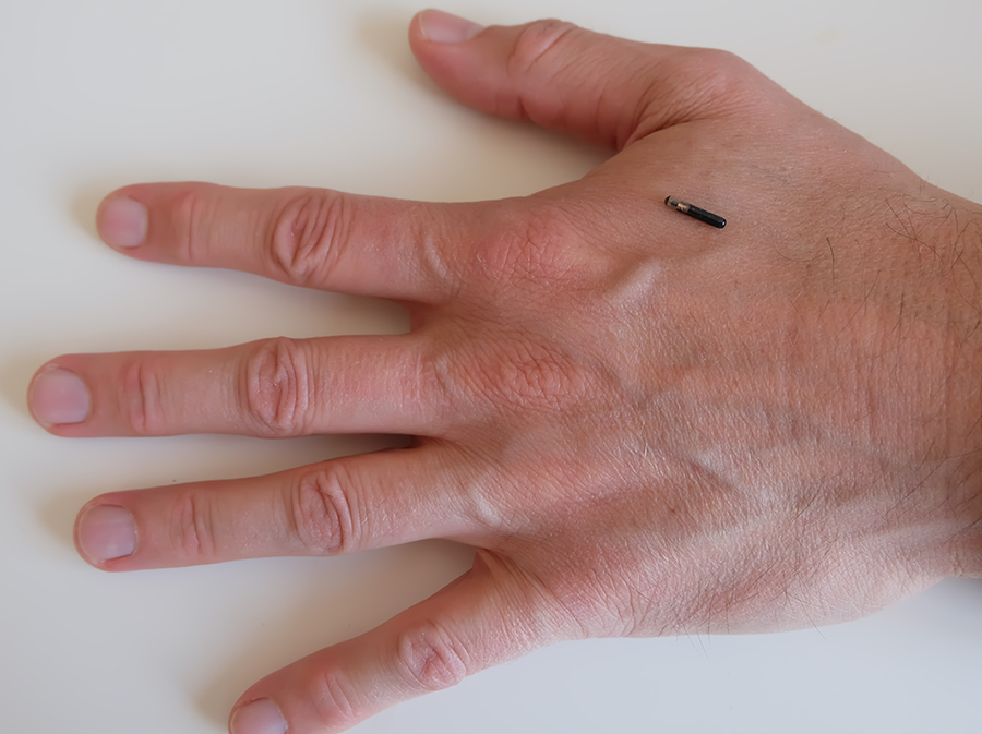 Der Transponder Chip wird unter die Haut gesetzt
